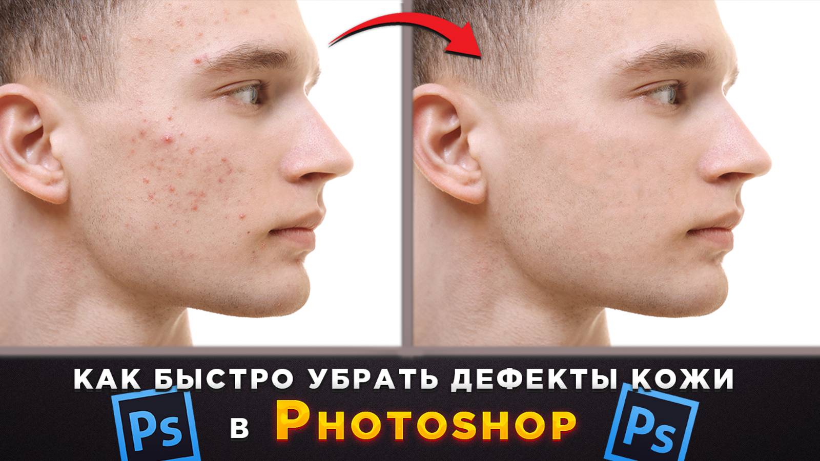 Как убрать прыщики, ретушь лица в Фотошопе Photoshop