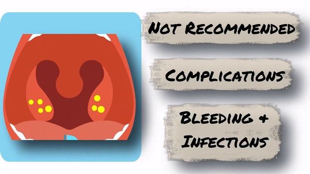 Tonsil Stones | Tonsil Stones Treatment | Tonsil Stone Removal - All You Need to Know