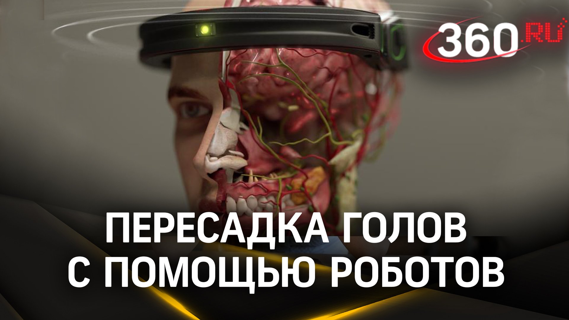 Пересадка головы реальна: робот-хирург склеивает спинной мозг с головным, чтобы спасти пациента