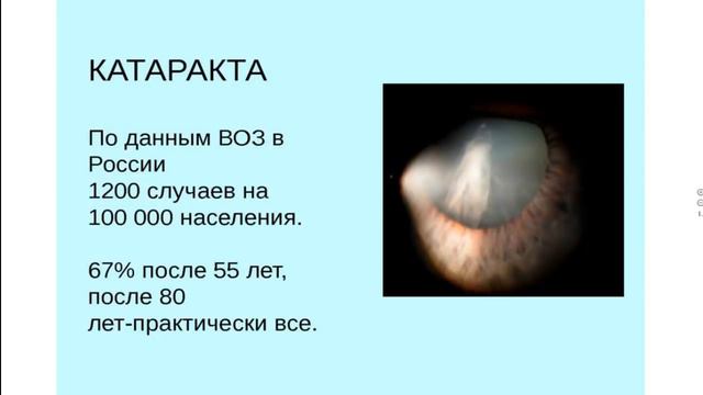 Глазные патологии и флуревиты