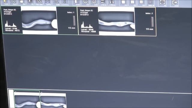 Egg Bound   Ball Python  X-Rays