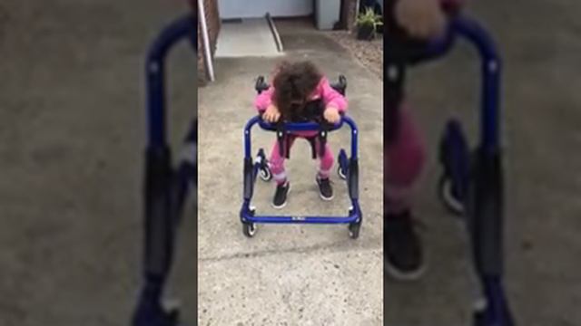 Leonie’s CP limbs