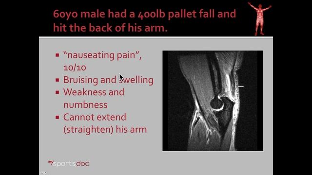 Surgery for Triceps Tear