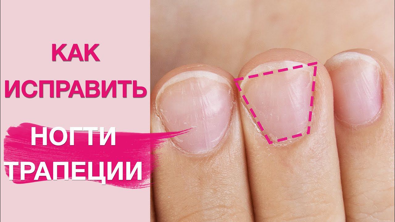 Маникюр на трапециевидные короткие ногти. Как изменить?