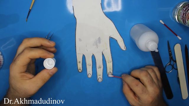 Лечение грибка ногтей дешево и эффективно (Онихомикоз)  Ахмадудинов А.М.