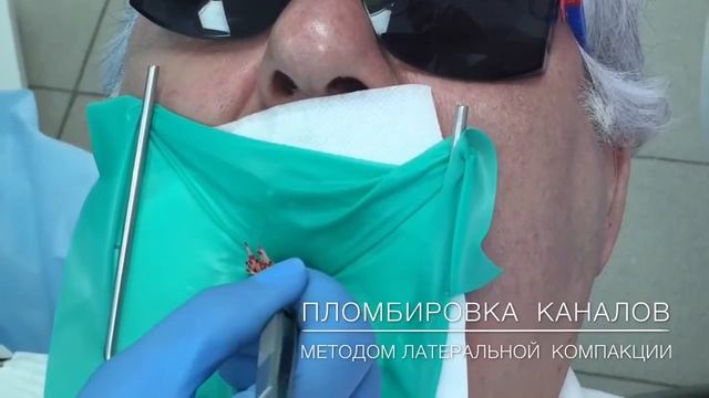 Пульпит этапы лечения.