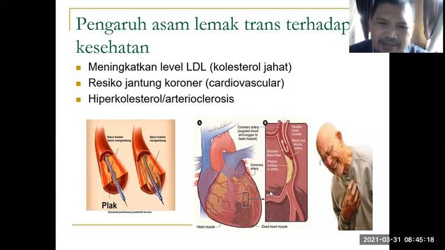 LIPID (STRUKTUR, FUNGSI  DAN PENGELOMPOKANNYA)
