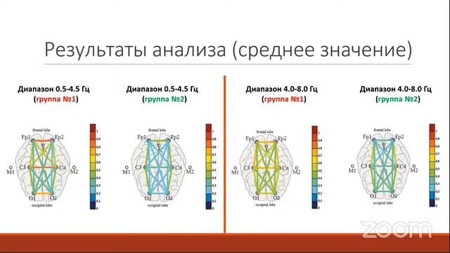 08.06.21 Био- и медицинские приложения волновой физики - 2