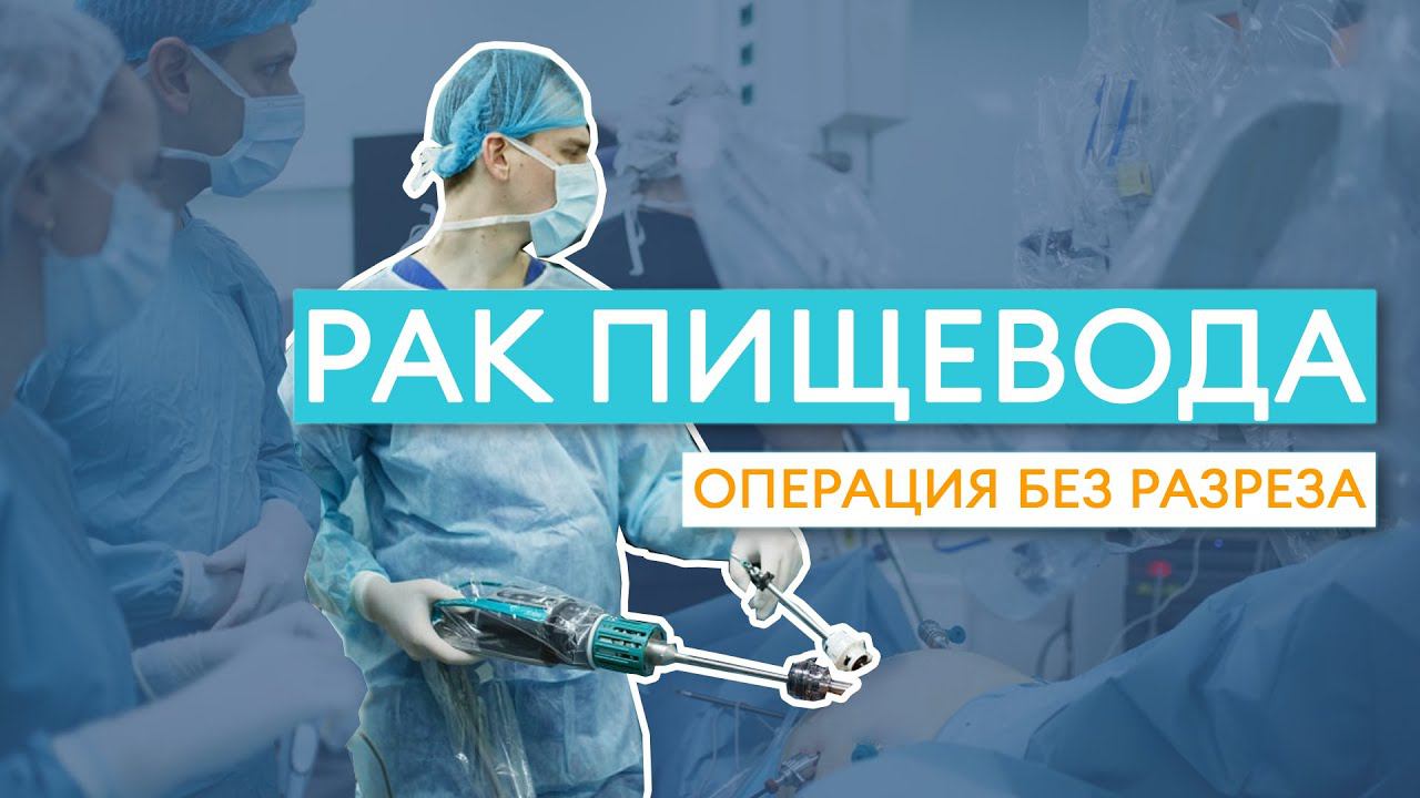 Рак пищевода: операция БЕЗ РАЗРЕЗА