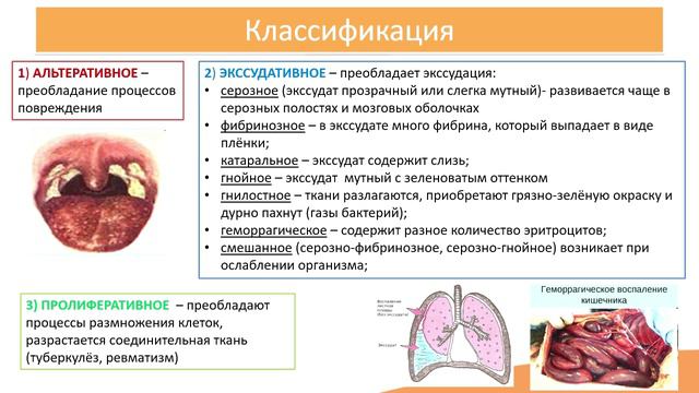 15.3. Классификация воспалений