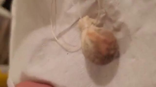 Yoni Pearl Results   Very  DETAILED  and GRAPHIC