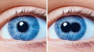 Два зрачка в одном глазу и другие странные особенности тела