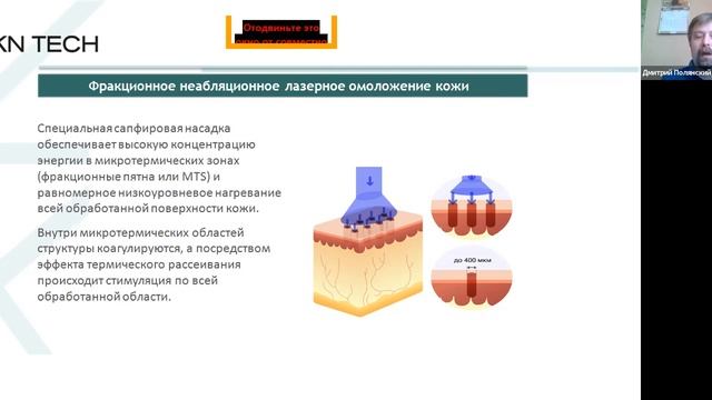 ФИЗИКА ЛАЗЕРА  Диодные технологии для удаления новообразований и сосудистых патологий