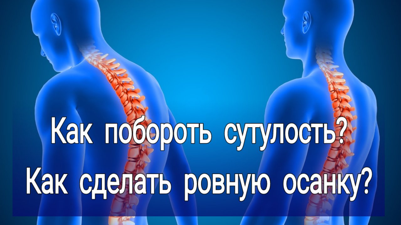 Как побороть сутулость? Как добиться ровной осанки?
