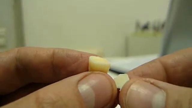 тест на  несовместимость адгезивных  систем  1