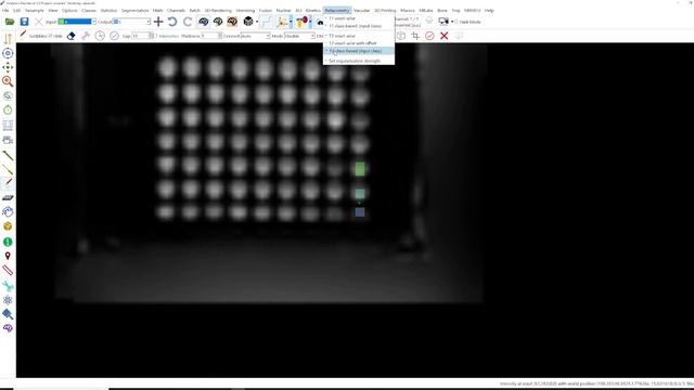 Tutorial video (MRI): "Relaxometry T2"