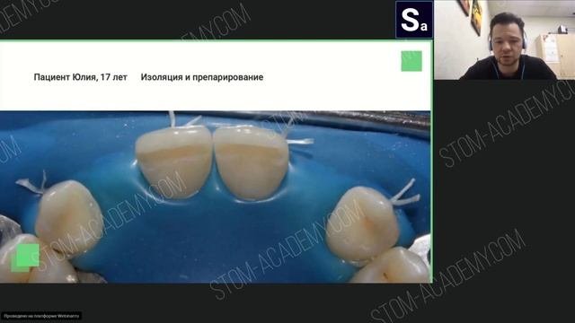 Сверхвозможности стоматолога-терапевта: прямые адгезивные реставрации.