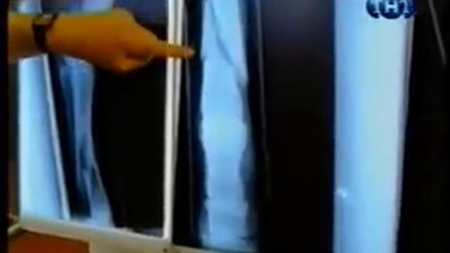 05.Лошадь сломала ногу.mpg