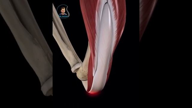 Triceps Tendinopathy
