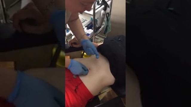 Pirsing pupka uzivo -  Belly piercing live