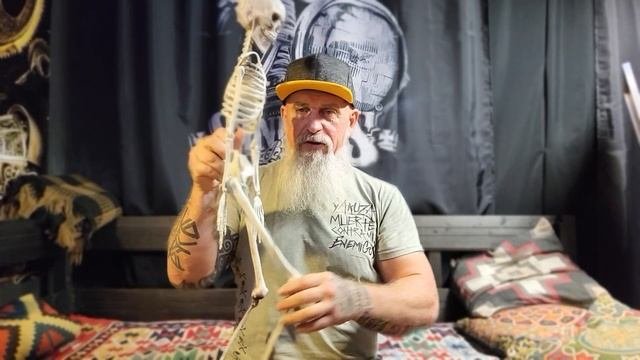 Алешенька коксартрозник.