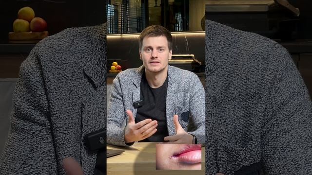 Причины герпеса и заедов на губах