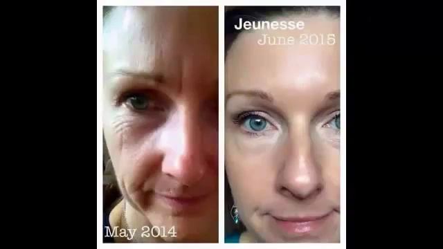 Шок!!! Морщины исчезают за 2 минуты!!! JEUNESSE