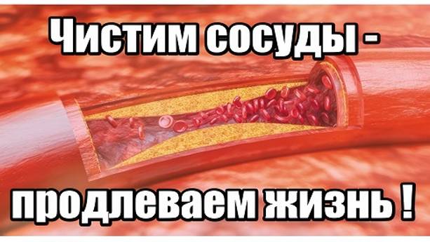 Чистим свои сосуды-продлеваем жизнь!