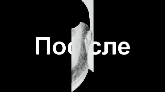 ШОК актеры сверхъестественное ДО И ПОСЛЕ