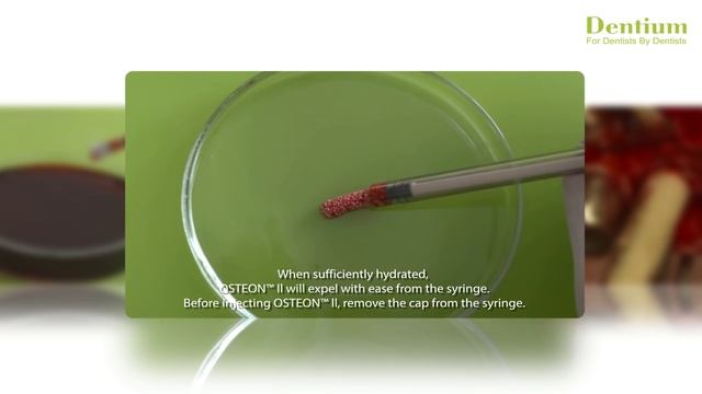 Handling of OSTEON ll syringe type