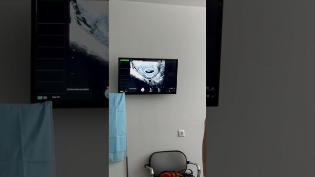 У Тима будет сестра/брат?