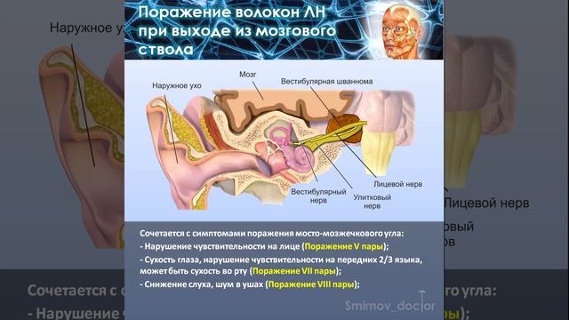 Клиническая диагностика поражений лицевого нерва