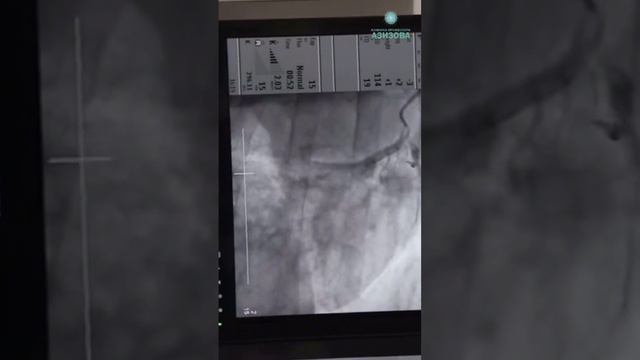 Ваше сердце в надежных руках! Врач кардиолог Шамиль Абубакарович про коронаграфию