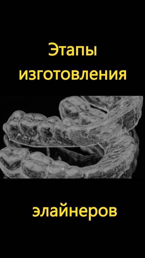 Этапы изготовления элайнеров 3D Smile