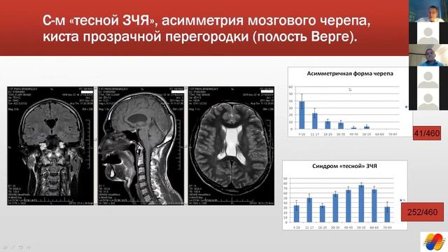 Летягин. "Анатомия ЦНС и формирование внутричерепного давления по данным МРТ"