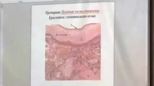 Плодная часть плаценты. Гистология