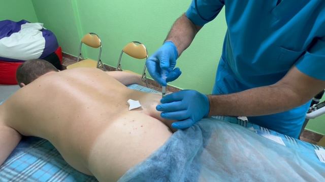постановка укола в точки куда ставятся иглы . безопасно внутримышечно