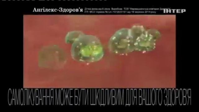 Ангилекс