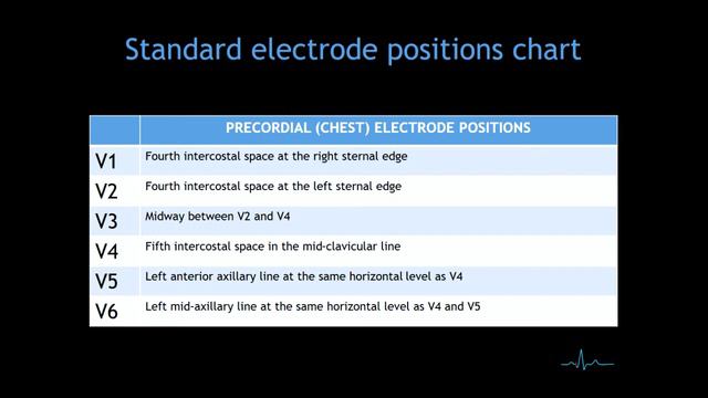 ECG: Standard electrode positions (Electrocardiogram)!