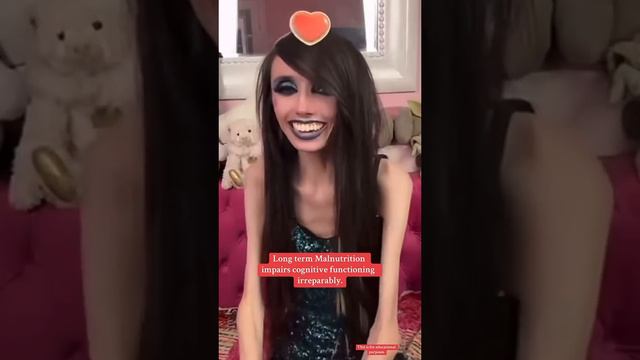 Eugenia Cooney before and after eugeniacooney education