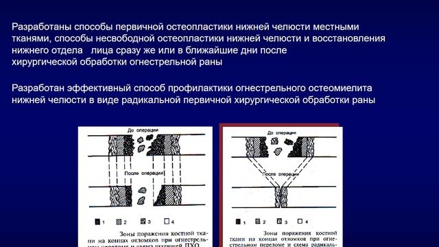 Краткая история развития военной челюстно-лицевой хирургии и травматологии