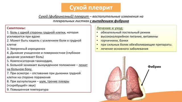 4.4. Плеврит