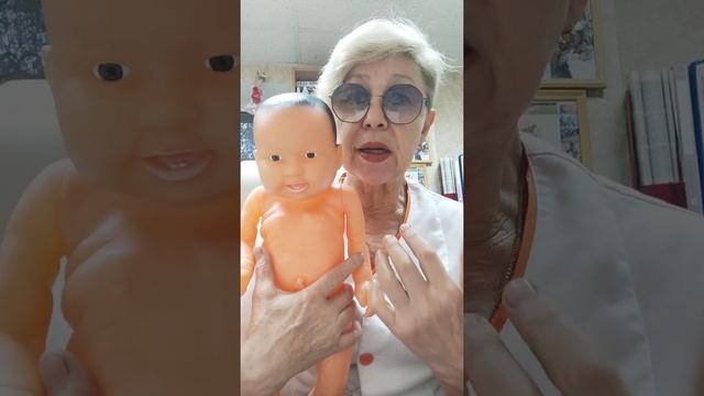 Кривошея у детей 32
