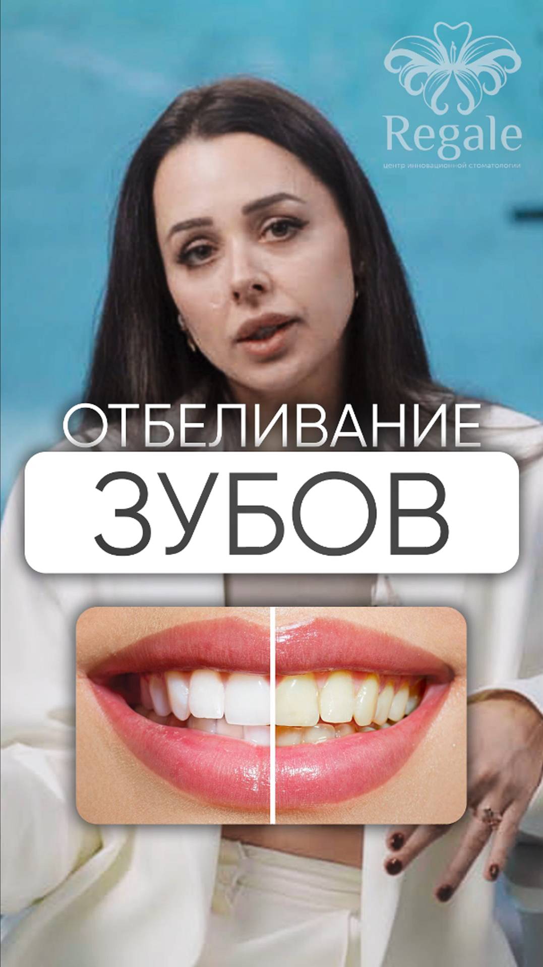 Как отбеливаются зубы?