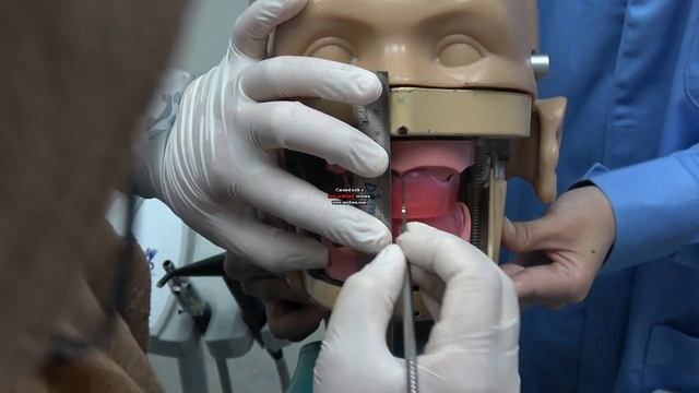 COMPLETE DENTURE: 6. Maxillomandibular registration (MMR)