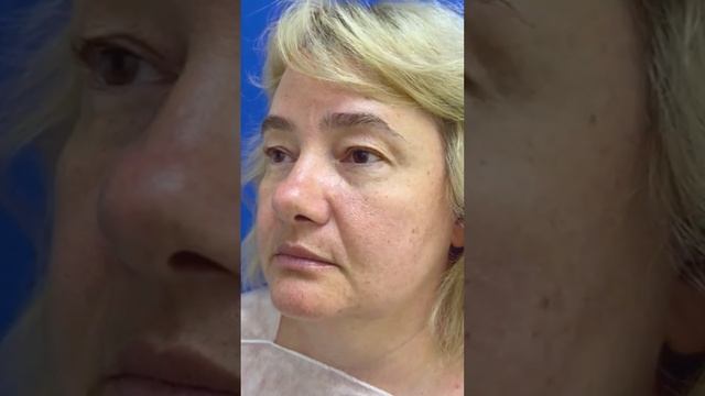 отзыв блефаро врач Мирзарахимов Р.