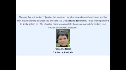 Hidradenitis Suppurativa Treatment - How To Cure Hidradenitis Suppurativa Naturally