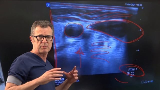 US-Guided Central Line: 10 Steps - Crash course with Dr. Hadzic