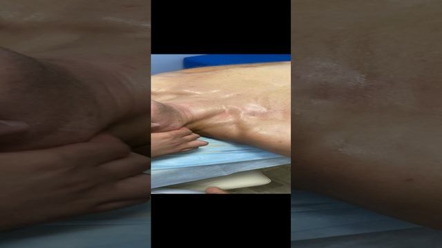 лечение головной боли массаж лестничных мышц