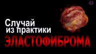 Хирургия в станице Ленинградской. Случай из практики клиники Гиппократ